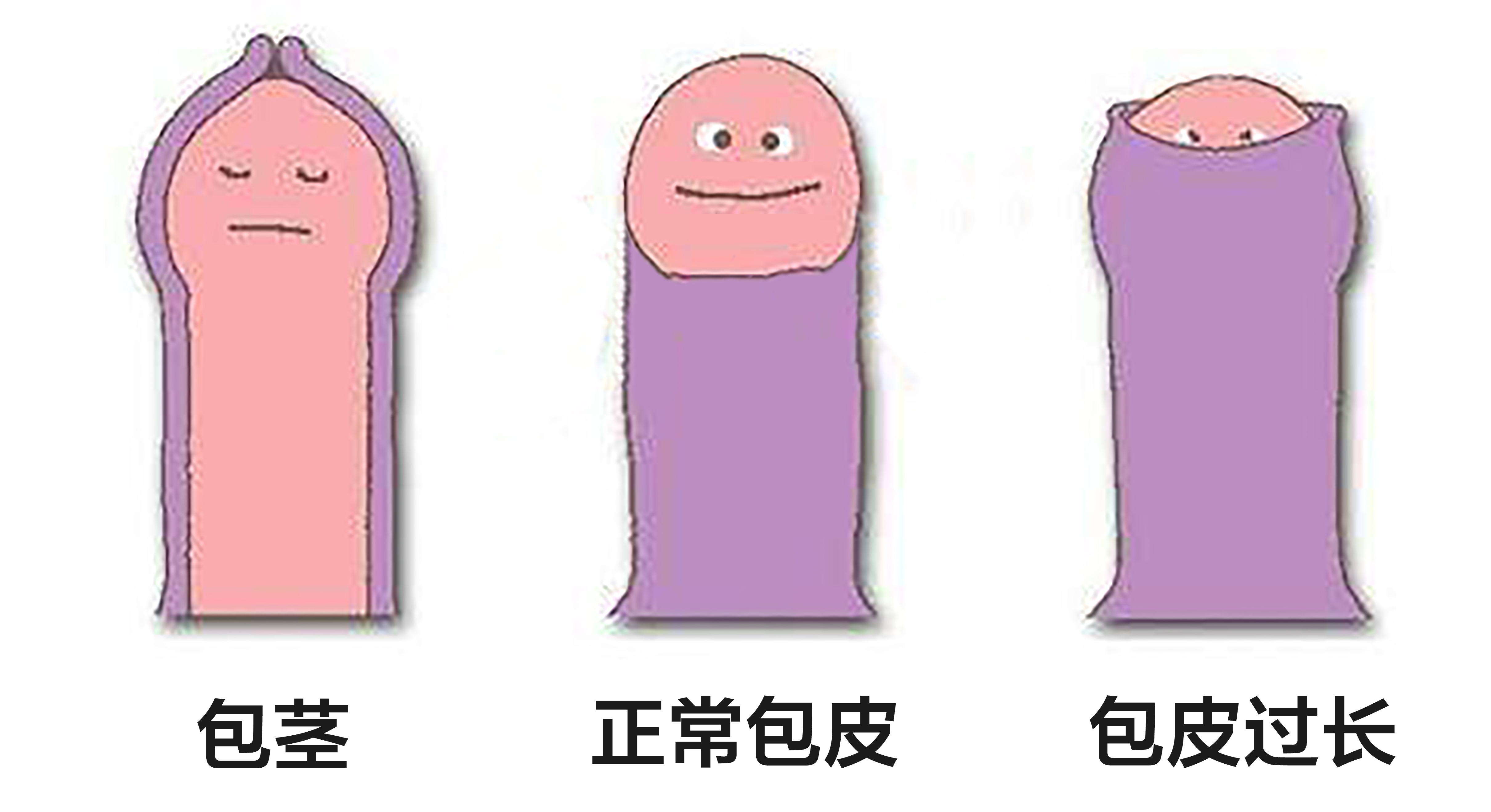 韶关割包皮，韶关割包皮多少钱，韶关圣亚